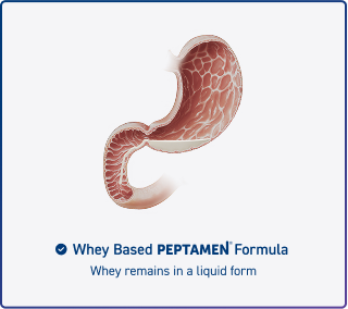 Whey Based Peptamen Formula