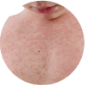 round-image-2